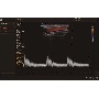 CCA Doppler képe
