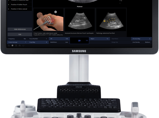 Samsung HS30 ultrahang készülék
